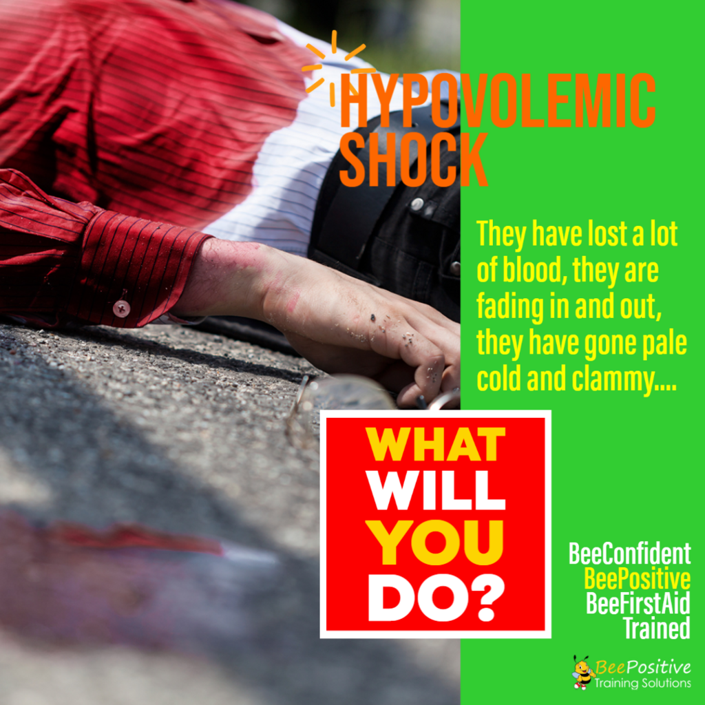 Hypovolemic Shock BeePositive Training Solutions